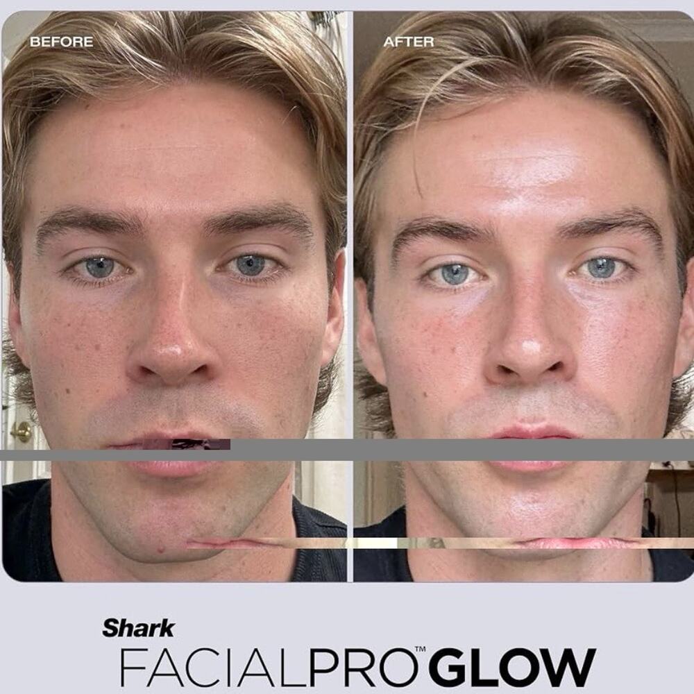 Shark FacialPro Glow at Home Hydro Powered Facial System FH320PL Open Box - Picture 16 of 16